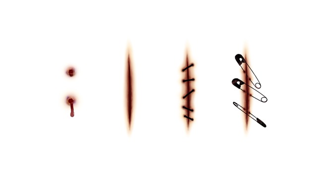 傷痕_ver2.1(グロ注意)